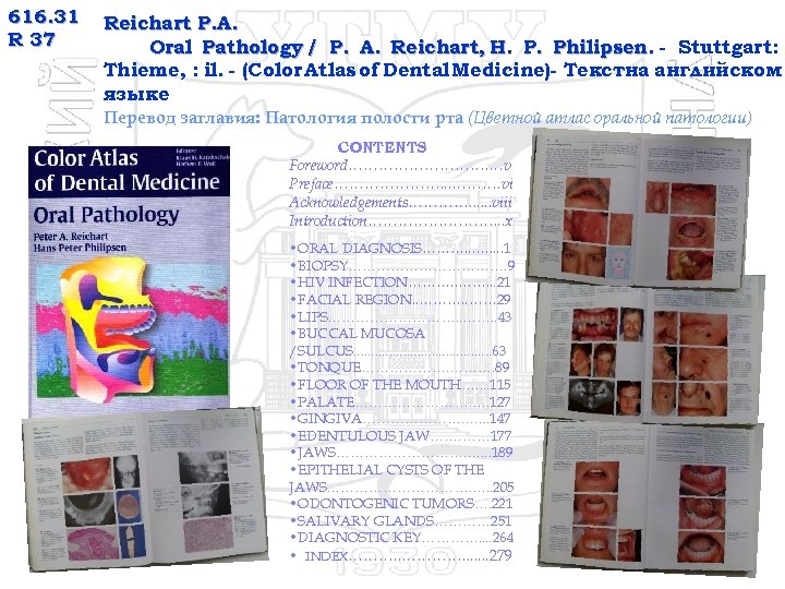 616. 31 R 37 Reichart P. A. Oral Pathology / P. A. Reichart, H.