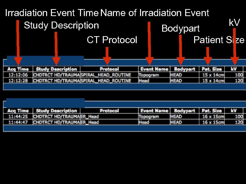 Irradiation Event Time Name of Irradiation Event Study Description Bodypart CT Protocol k. V