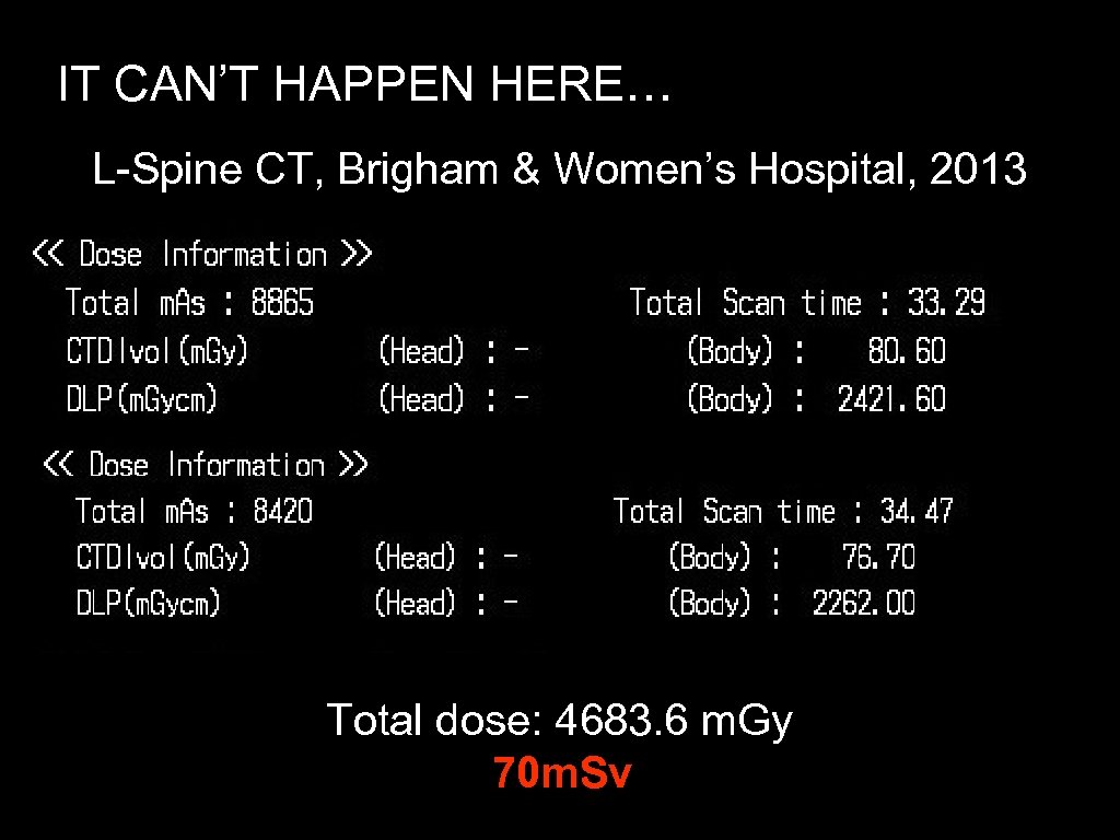 IT CAN’T HAPPEN HERE… L-Spine CT, Brigham & Women’s Hospital, 2013 Total dose: 4683.