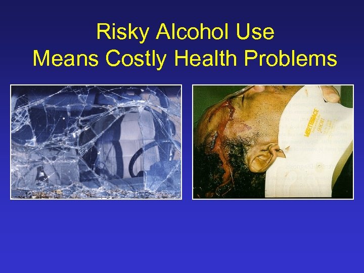 Risky Alcohol Use Means Costly Health Problems 