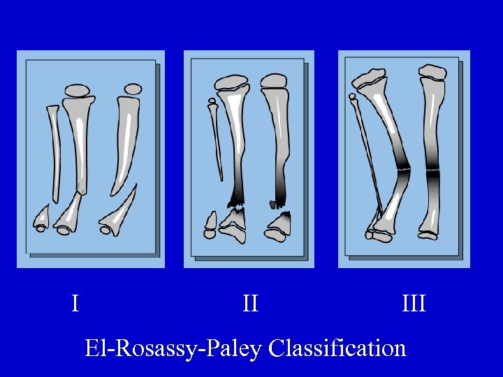 I II III El-Rosassy-Paley Classification 