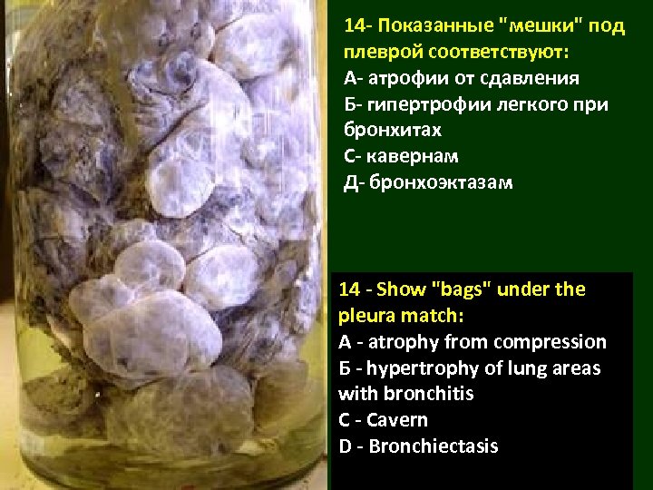 14 - Показанные 