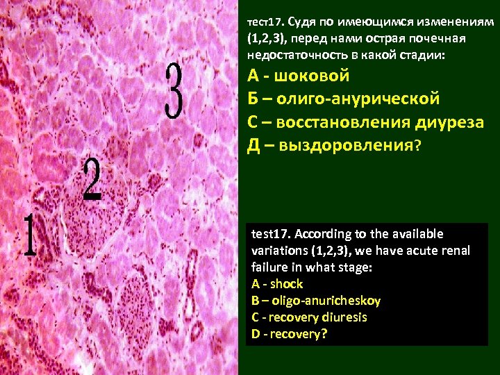 Презентация шок патанатомия