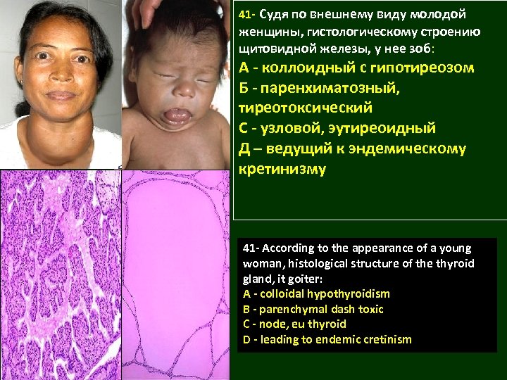 41 - Судя по внешнему виду молодой болезни- виды, причины (538 -539) Общая характеристика