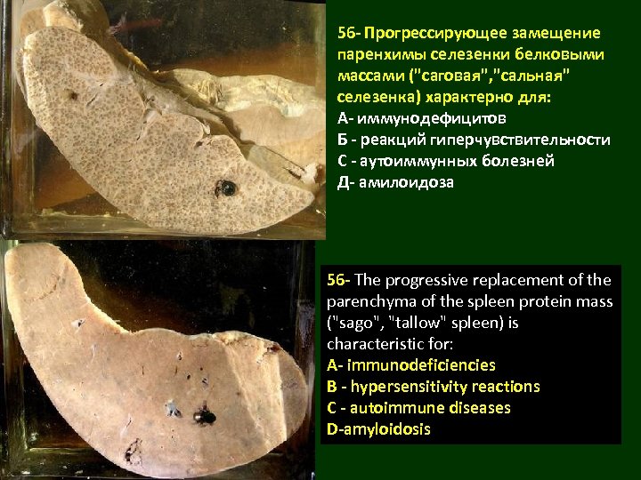 Саговая селезенка микропрепарат рисунок