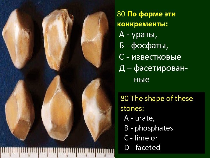 80 По форме эти конкременты: А - ураты, Б - фосфаты, С - известковые