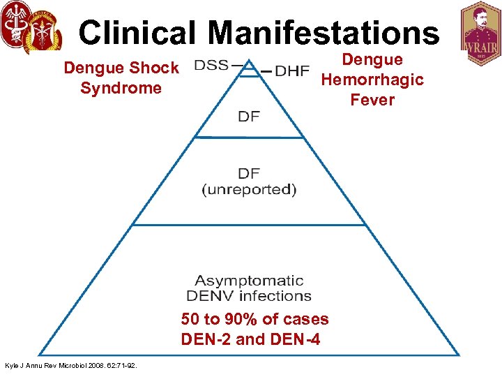 Clinical Manifestations Dengue Shock Syndrome Dengue Hemorrhagic Fever 50 to 90% of cases DEN-2