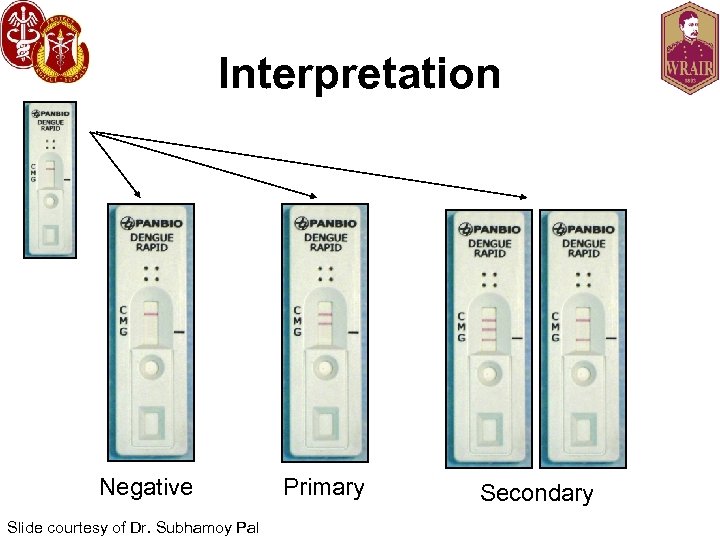 Interpretation Negative Slide courtesy of Dr. Subhamoy Pal Primary Secondary 