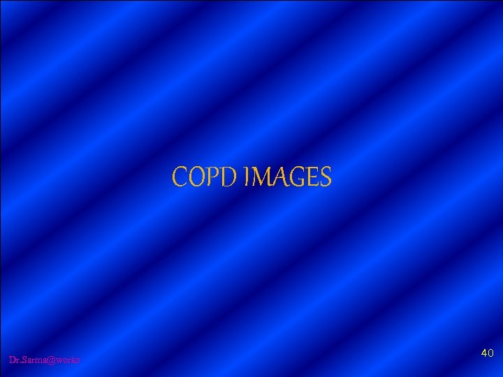 COPD IMAGES Dr. Sarma@works 40 