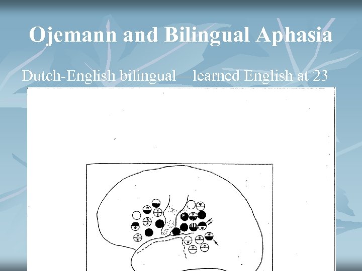 Ojemann and Bilingual Aphasia Dutch-English bilingual—learned English at 23 when came to live in