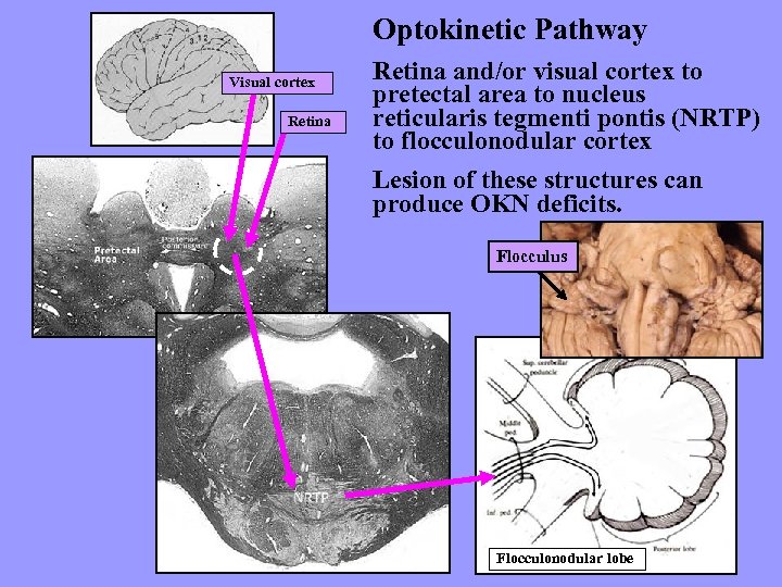 Optokinetic Pathway Visual cortex Retina and/or visual cortex to pretectal area to nucleus reticularis