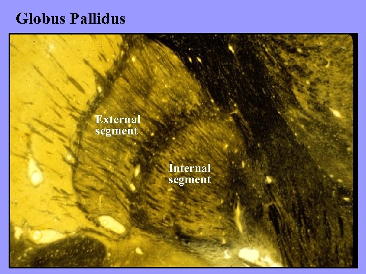 Globus Pallidus External segment Internal segment 