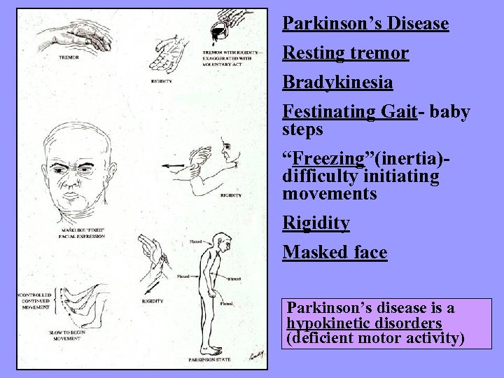 Parkinson’s Disease Resting tremor Bradykinesia Festinating Gait- baby steps “Freezing”(inertia)difficulty initiating movements Rigidity Masked