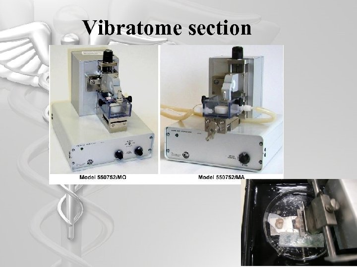 Vibratome section 