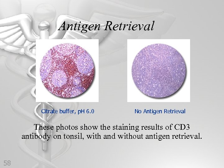 Antigen Retrieval Citrate buffer, p. H 6. 0 No Antigen Retrieval These photos show