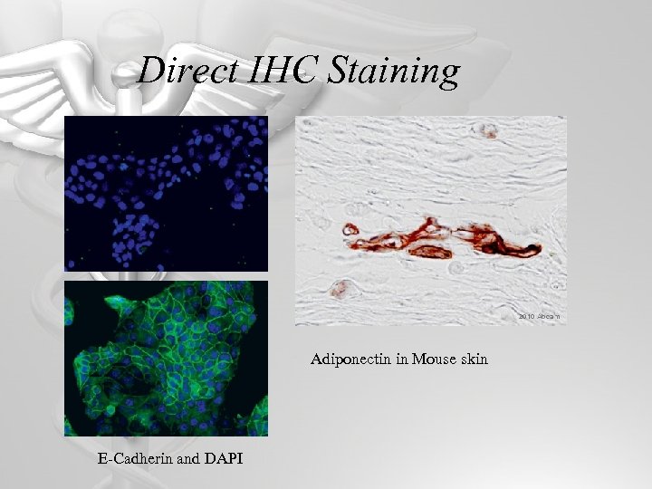 Direct IHC Staining Adiponectin in Mouse skin E-Cadherin and DAPI 