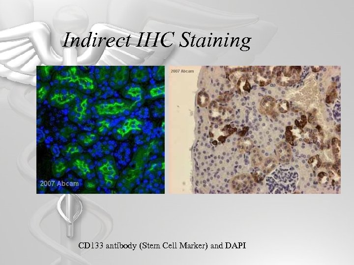 Indirect IHC Staining CD 133 antibody (Stem Cell Marker) and DAPI 