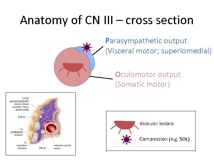 Anatomy of CN III – cross section Parasympathetic output (Visceral motor; superiomedial) Oculomotor output