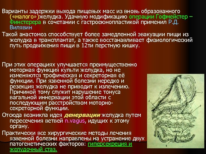 Варианты задержки выхода пищевых масс из вновь образованного ( «малого» )желудка. Удачную модификацию операции