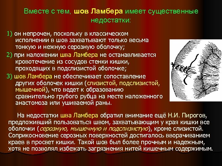 Вместе с тем, шов Ламбера имеет существенные недостатки: 1) он непрочен, поскольку в классическом