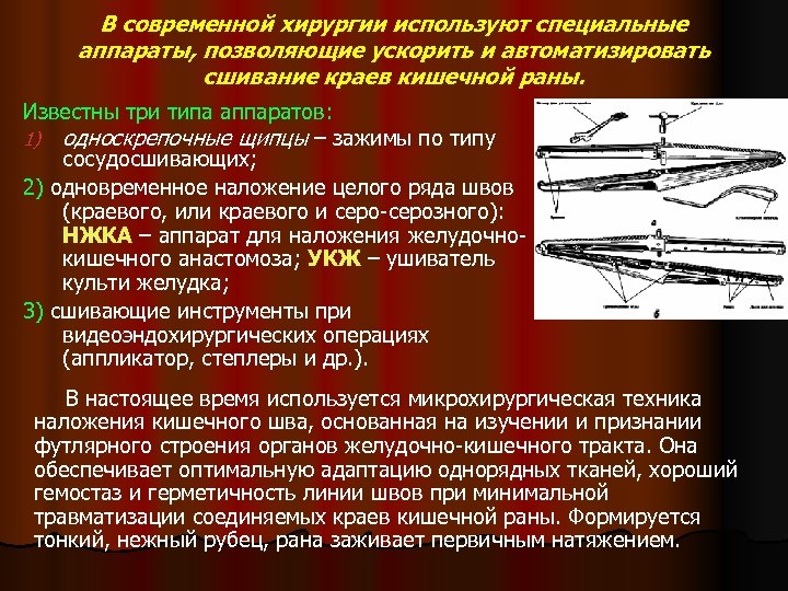 В современной хирургии используют специальные аппараты, позволяющие ускорить и автоматизировать сшивание краев кишечной раны.