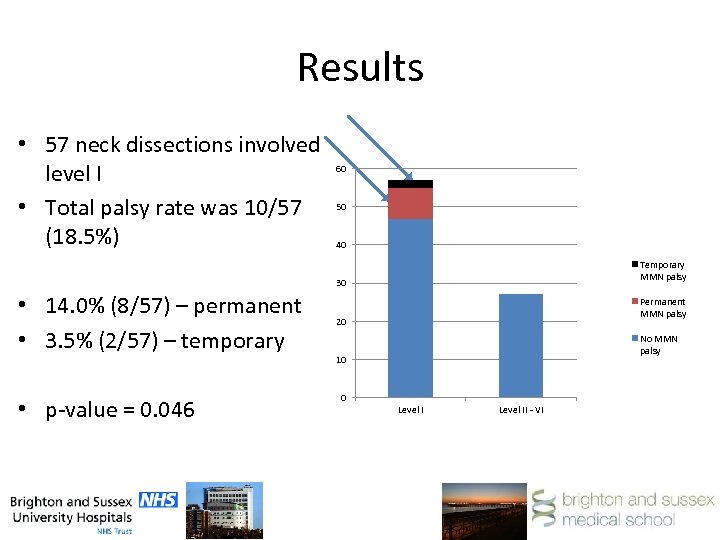 Results • 57 neck dissections involved level I • Total palsy rate was 10/57