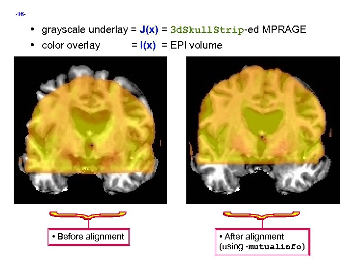 -16 - • grayscale underlay = J(x) = 3 d. Skull. Strip-ed MPRAGE •