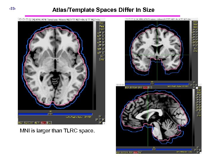 -33 - Atlas/Template Spaces Differ In Size MNI is larger than TLRC space. 