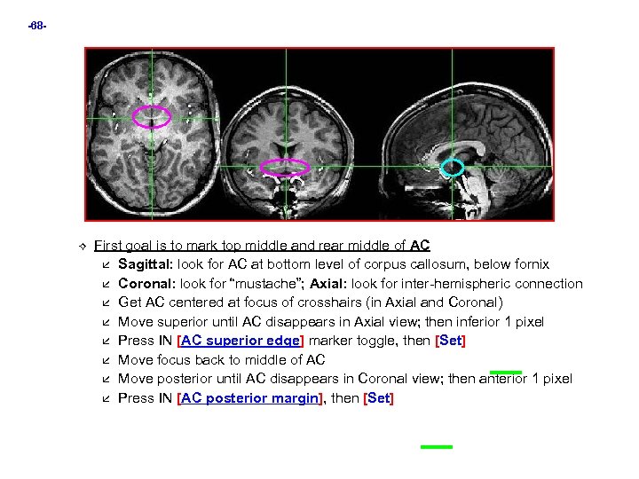 -68 - First goal is to mark top middle and rear middle of AC