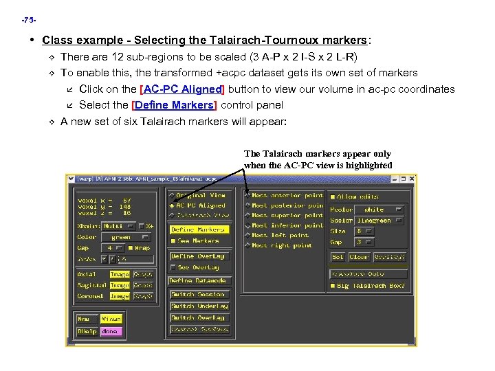 -75 - • Class example - Selecting the Talairach-Tournoux markers: There are 12 sub-regions