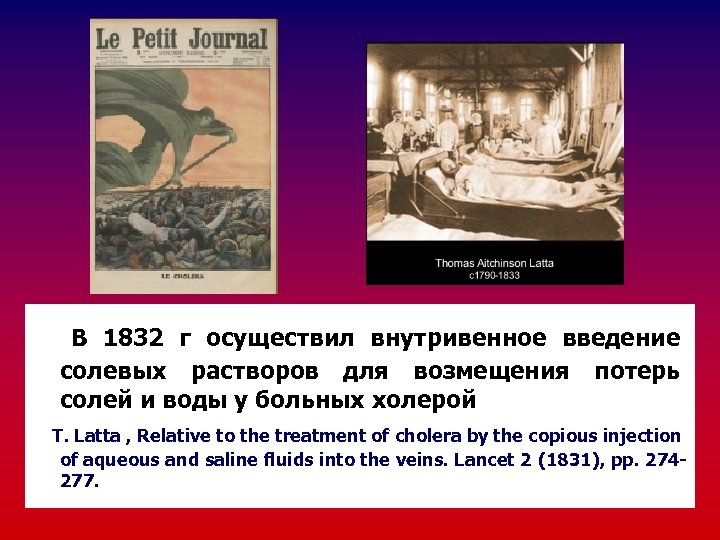  В 1832 г осуществил внутривенное введение солевых растворов для возмещения потерь солей и