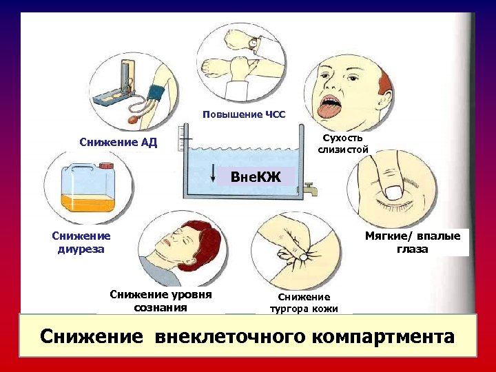 Повышение ЧСС Сухость слизистой Снижение АД Вне. КЖ Мягкие/ впалые глаза Снижение диуреза Снижение