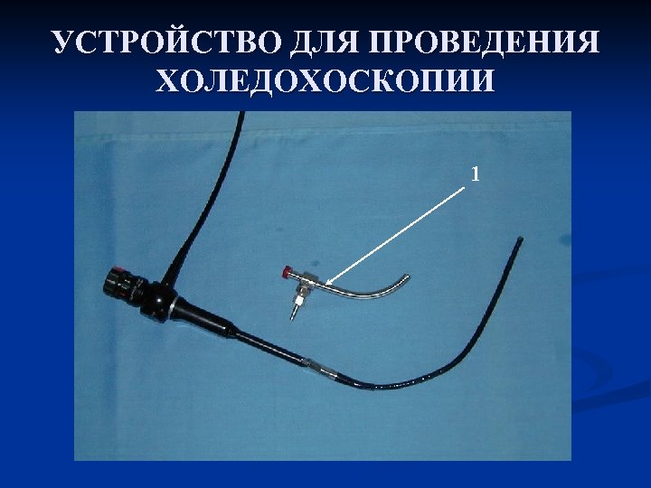 УСТРОЙСТВО ДЛЯ ПРОВЕДЕНИЯ ХОЛЕДОХОСКОПИИ 1 