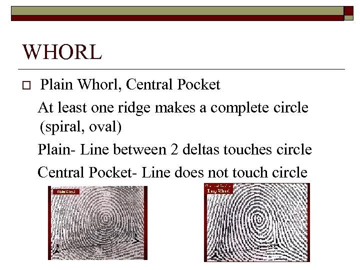 WHORL o Plain Whorl, Central Pocket At least one ridge makes a complete circle