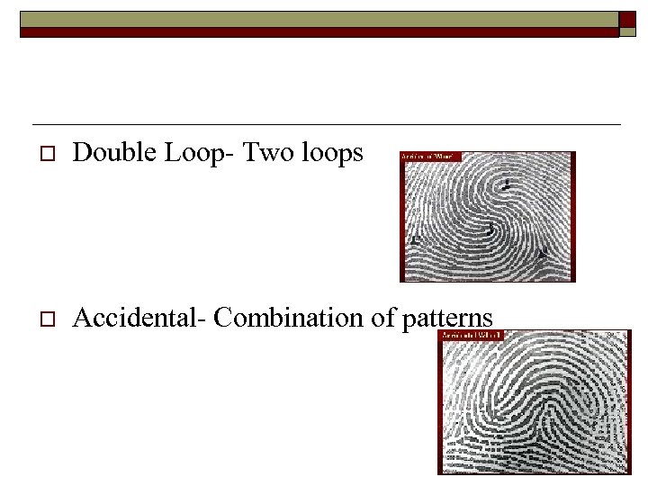 o Double Loop- Two loops o Accidental- Combination of patterns 