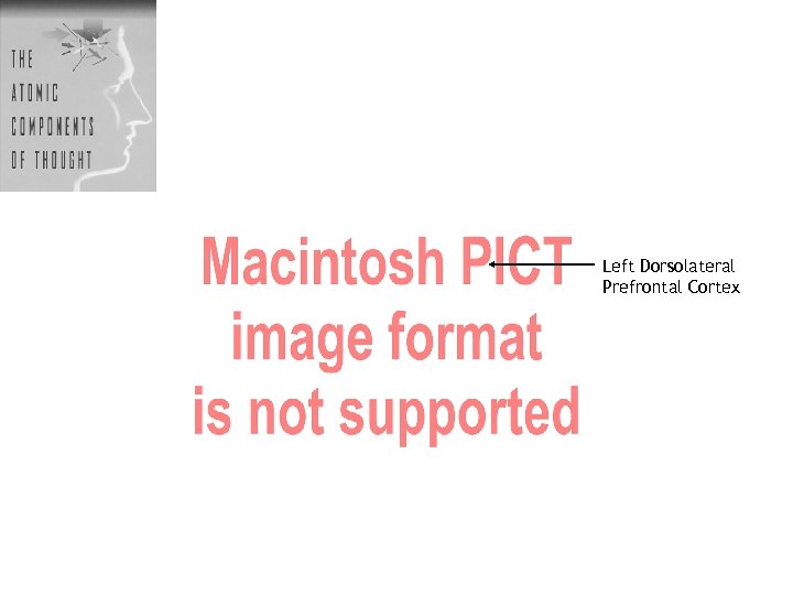 Left Dorsolateral Prefrontal Cortex 