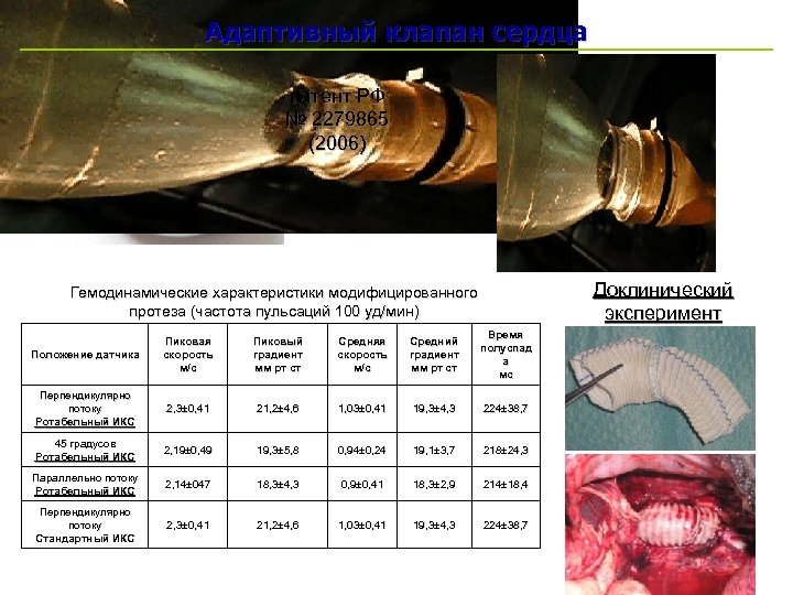Адаптивный клапан сердца патент РФ № 2279865 (2006) Доклинический эксперимент Гемодинамические характеристики модифицированного протеза