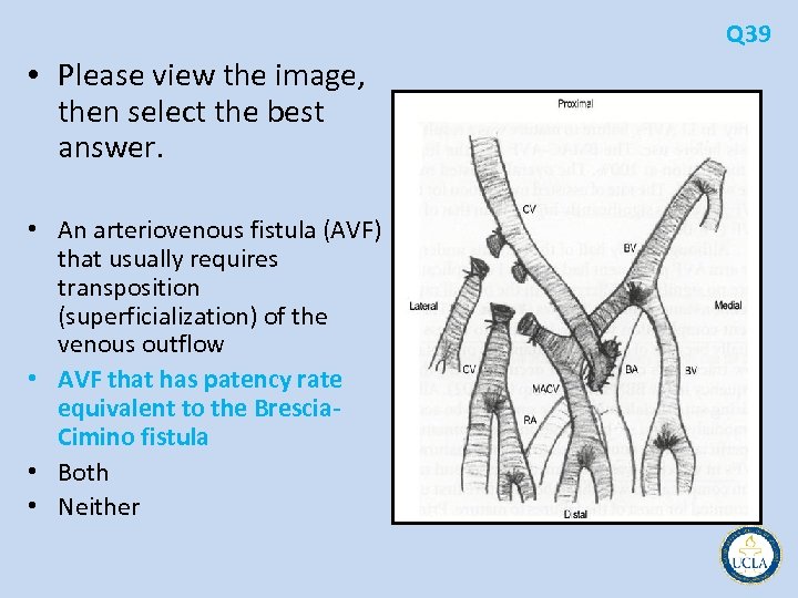 Q 39 • Please view the image, then select the best answer. • An