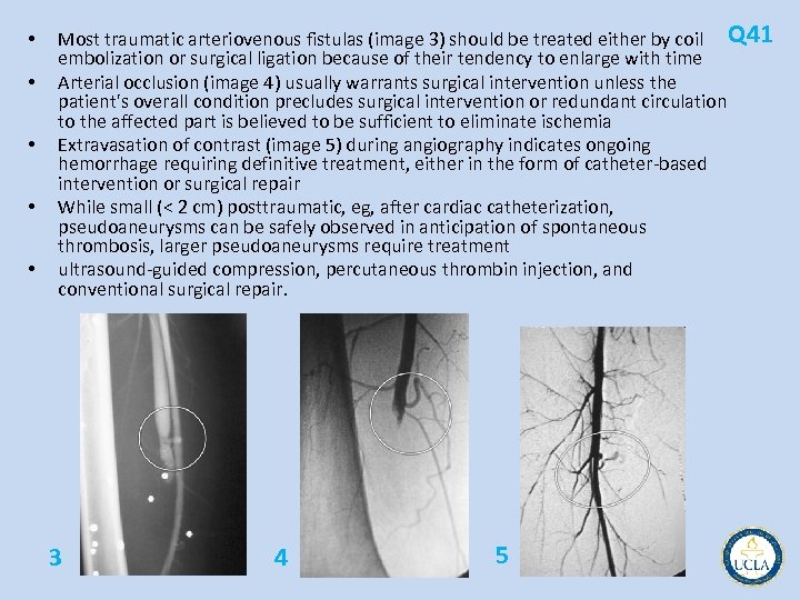  • • • Most traumatic arteriovenous fistulas (image 3) should be treated either