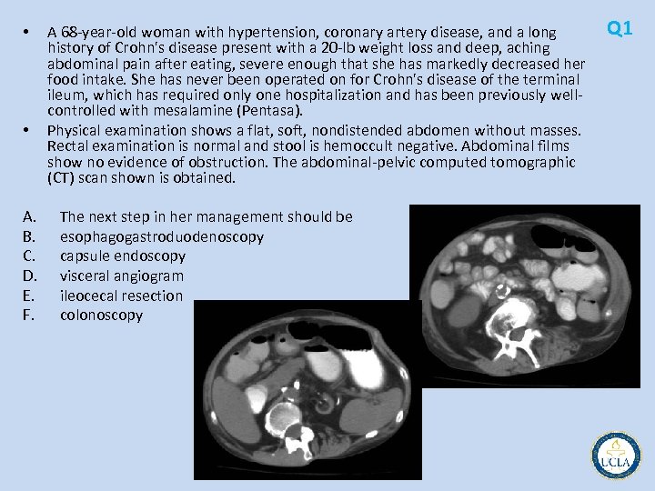  • • A. B. C. D. E. F. A 68 year old woman