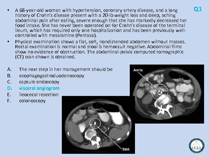  • • A. B. C. D. E. F. A 68 year old woman