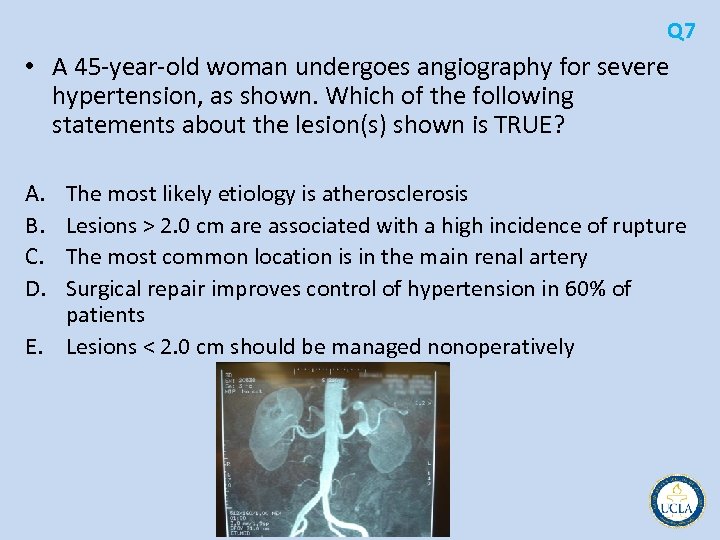 Q 7 • A 45 year old woman undergoes angiography for severe hypertension, as