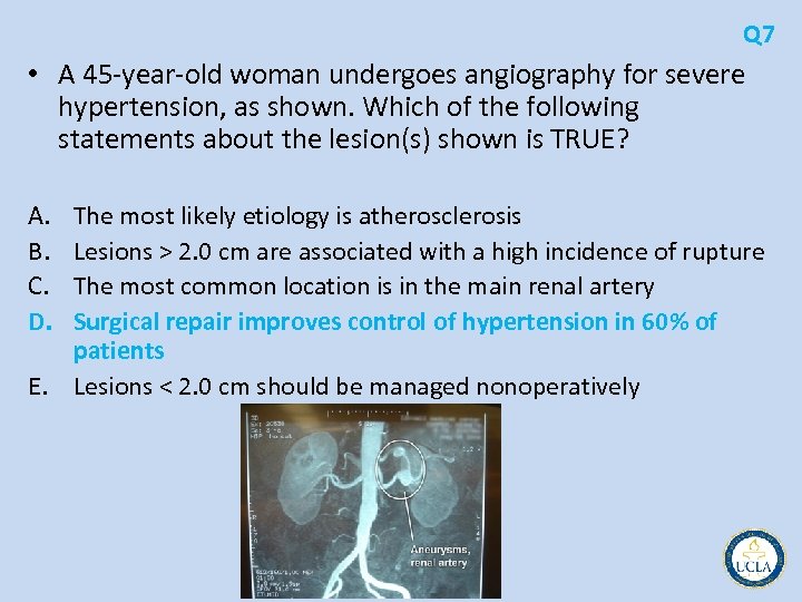 Q 7 • A 45 year old woman undergoes angiography for severe hypertension, as