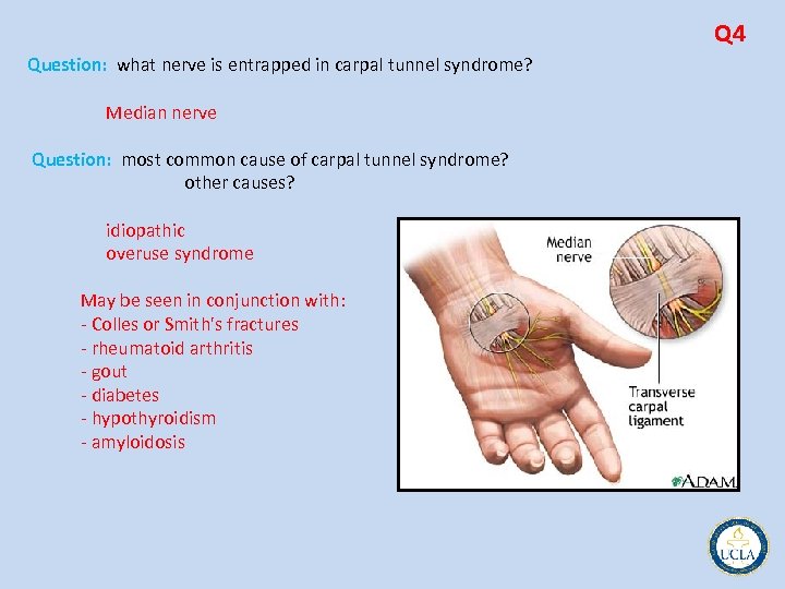 Q 4 Question: what nerve is entrapped in carpal tunnel syndrome? Median nerve Question:
