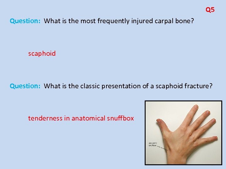 Q 5 Question: What is the most frequently injured carpal bone? scaphoid Question: What
