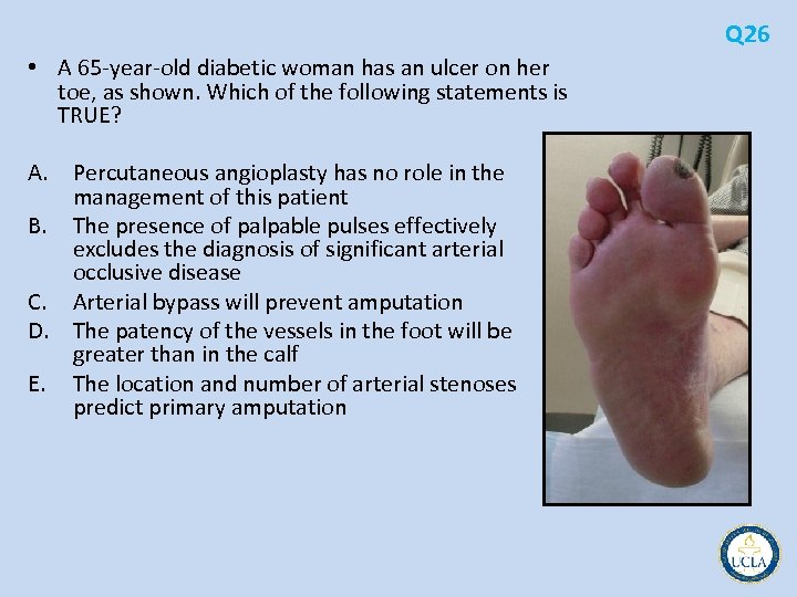 Q 26 • A 65 year old diabetic woman has an ulcer on her