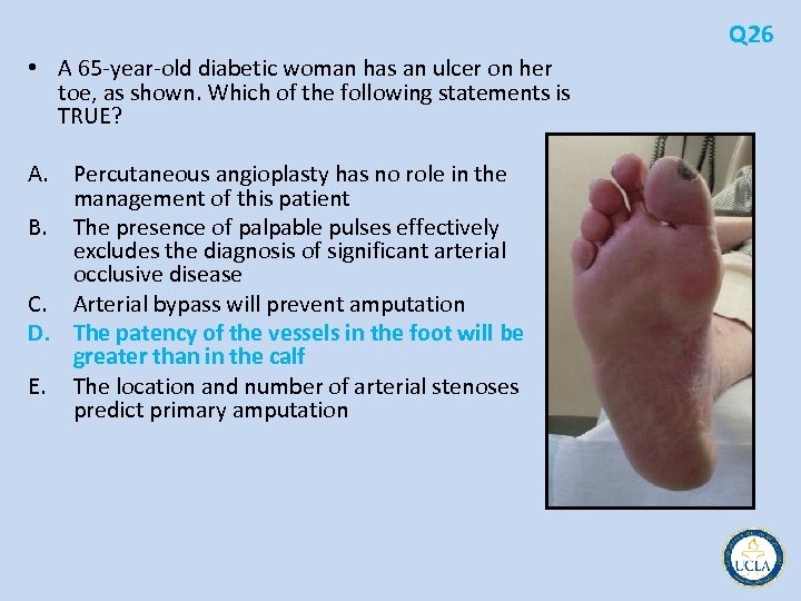 Q 26 • A 65 year old diabetic woman has an ulcer on her