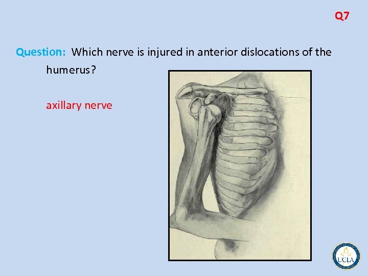 Q 7 Question: Which nerve is injured in anterior dislocations of the humerus? axillary