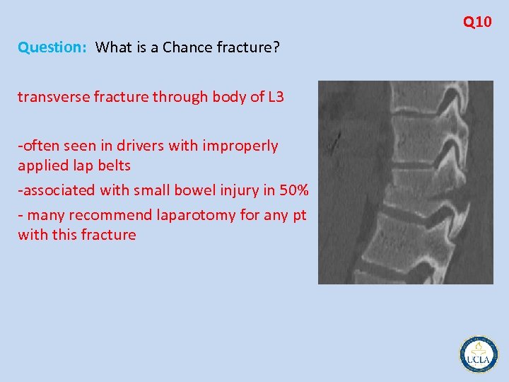 Q 10 Question: What is a Chance fracture? transverse fracture through body of L