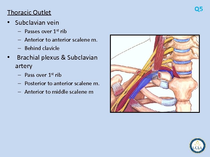 Thoracic Outlet • Subclavian vein – Passes over 1 st rib – Anterior to